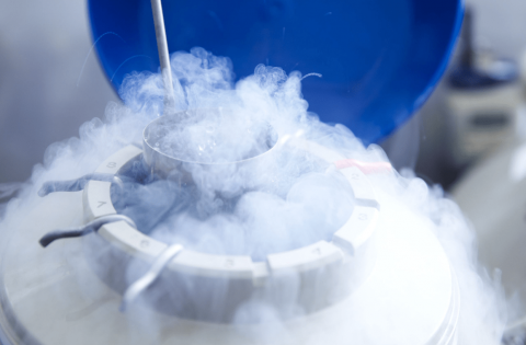 Freezing Sperm Reasons, Procedure, Outcomes, and Costs