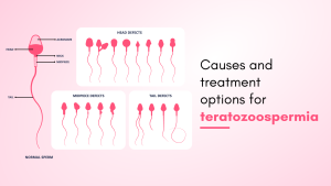 Causes and Treatment Options to Consider