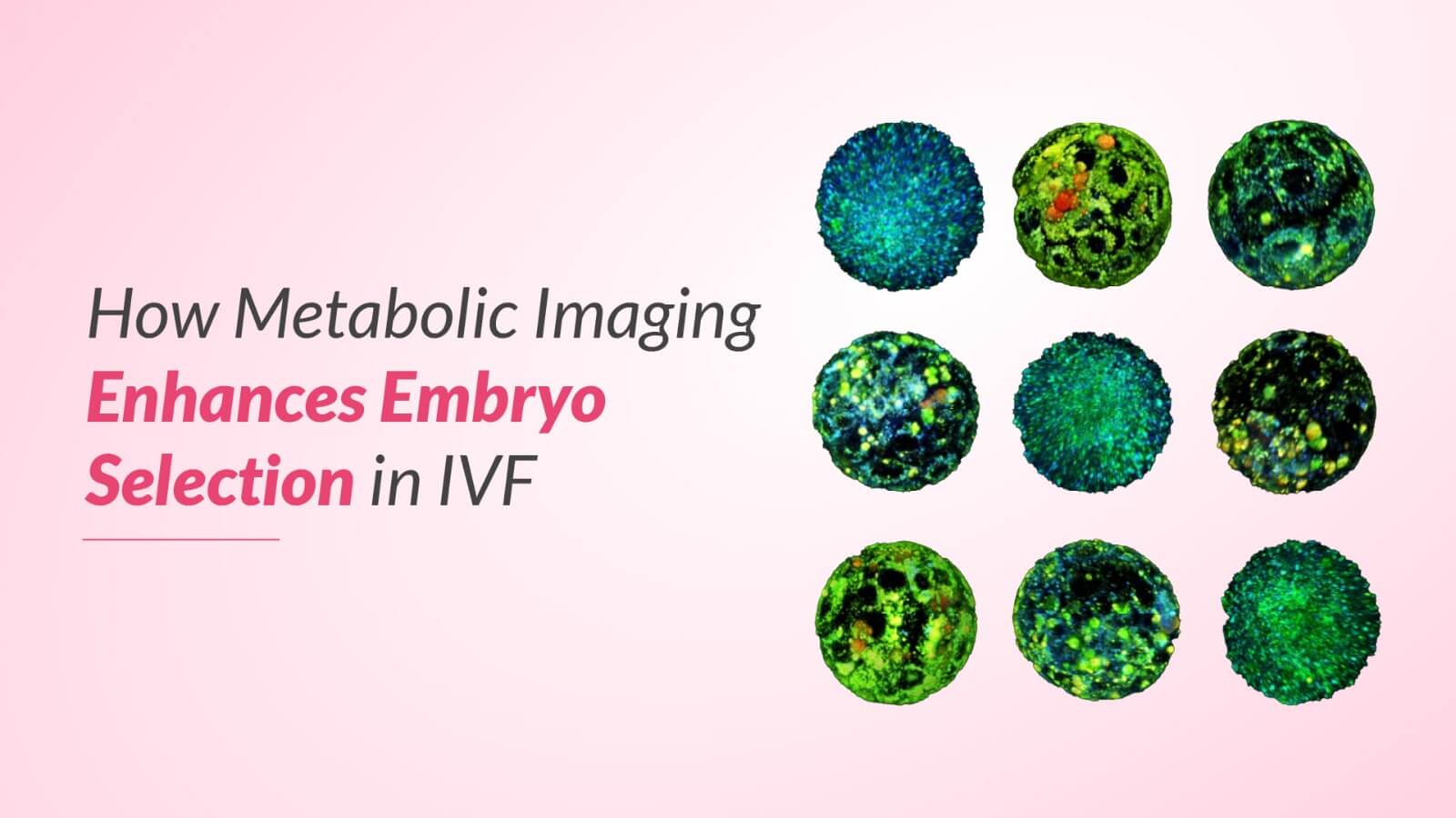 Metabolic Imaging Enhances Embryo Selection in IVF