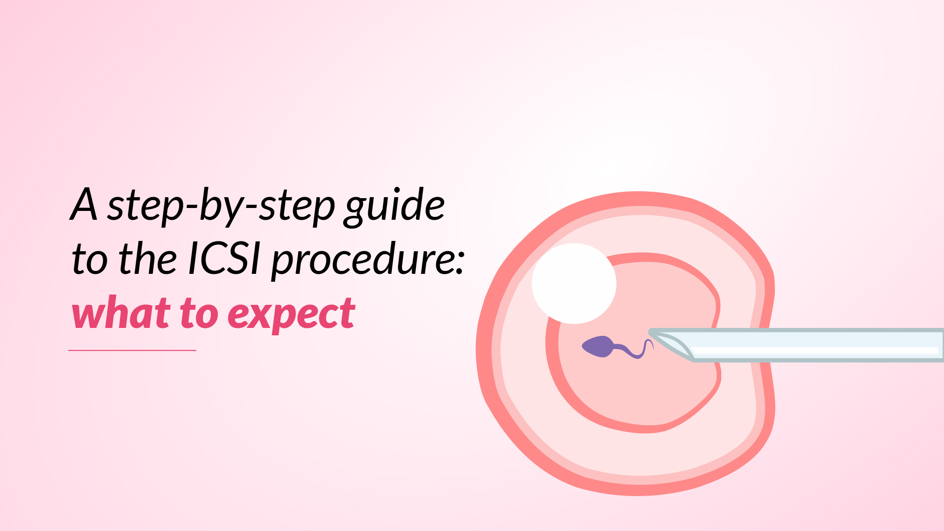 A Complete Step by Step Guide To The ICSI Procedure