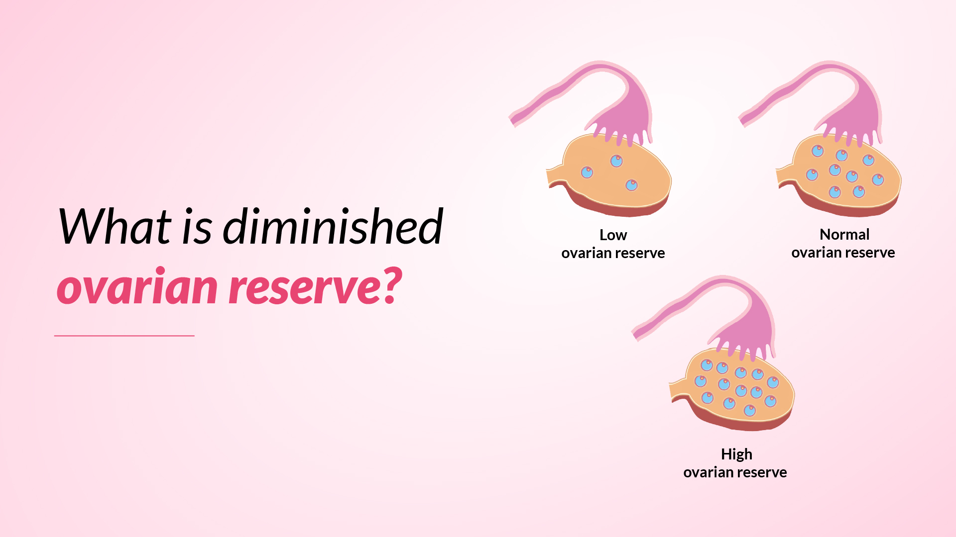 What is diminished ovarian reserve